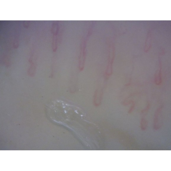 Microscopio Digital Dino-Lite CapillaryScope 200 Pro (MEDL4N Pro)