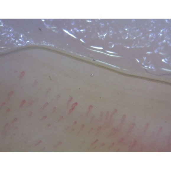 Microscopio Digital Dino-Lite CapillaryScope 200 Pro (MEDL4N Pro)