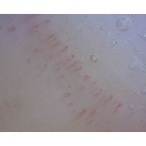 Microscopio Digital Dino-Lite CapillaryScope 200 Pro (MEDL4N Pro)