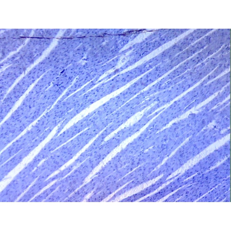 Caja de preparaciones 25 unidades