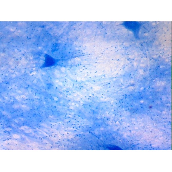 Caja de preparaciones 25 unidades