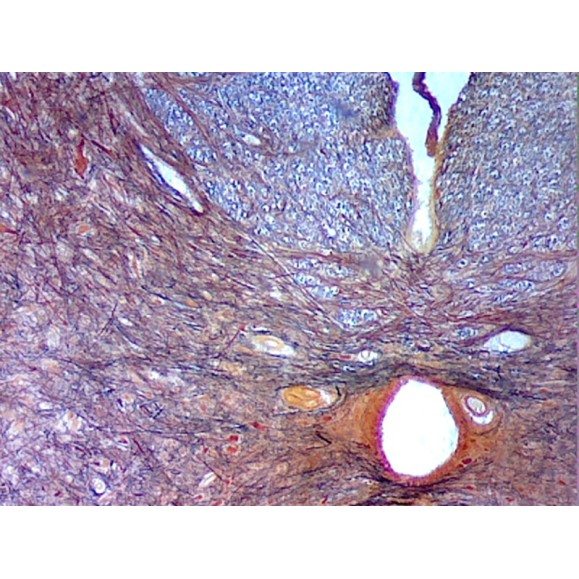 Caja de preparaciones 25 unidades