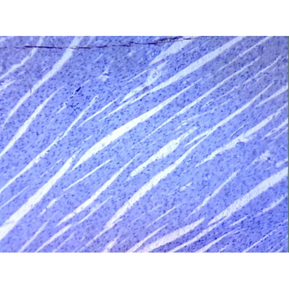 Caja de preparaciones 100 unidades Caja de preparaciones 100 unidades